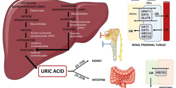 Asymptomatic hyperuricemia: to treat or not a threat?